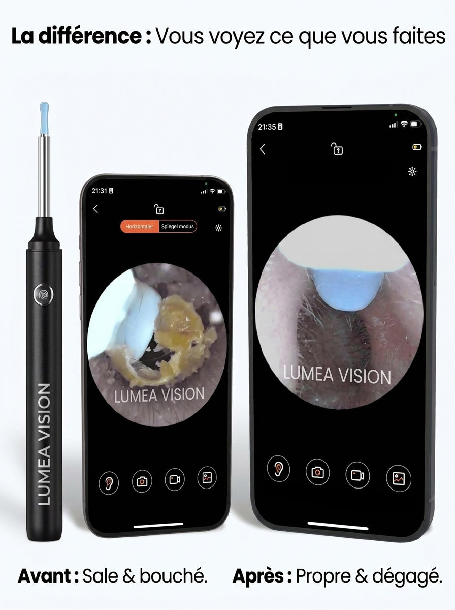 Lumea Ear Vision™ - Nettoyage d'oreille intelligent avec technologie avancée